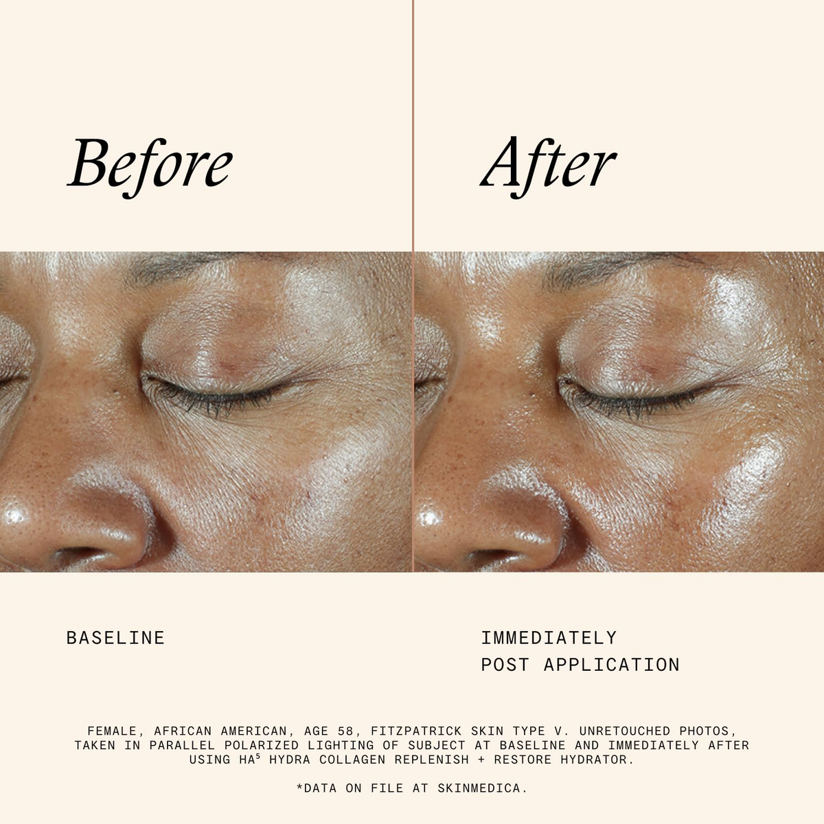 HA⁵® Hydra Collagen Hydrator with Vegan Collagen